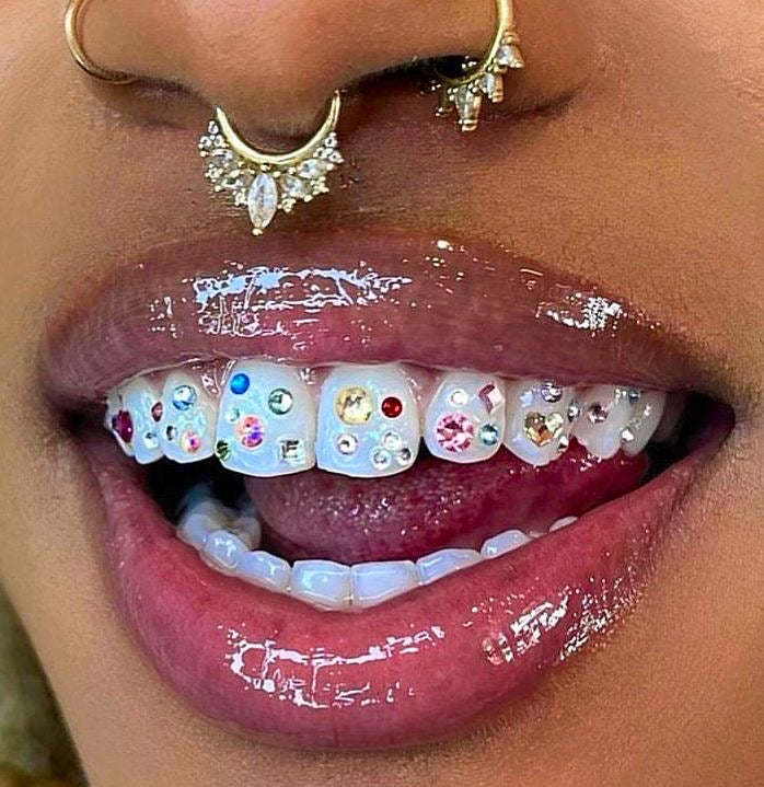 Gemas dentales